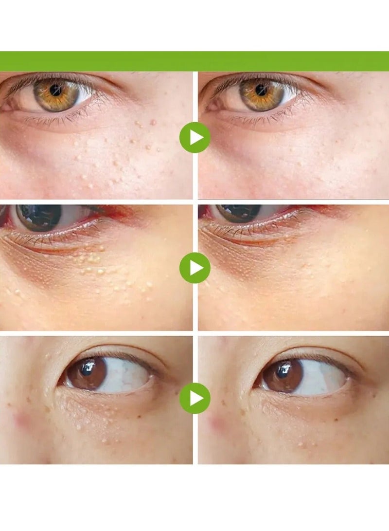 سوميفون فيتامين E كريم حبيبات الدهون الشركات وإصلاح الجلد حول العينين دعم صحة العين إزالة فعالة من جزيئات الدهون الحبيبات العناية بالعين محددة تحت كريم العناية بالعين 20g - Image 3